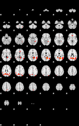 Patients 29178 23