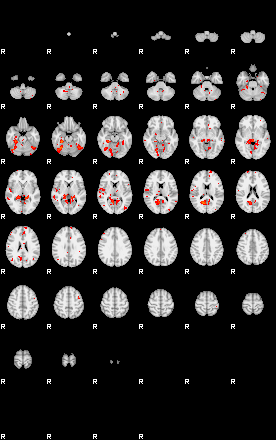 Patients 29178 84