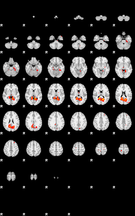 Patients 29179 25