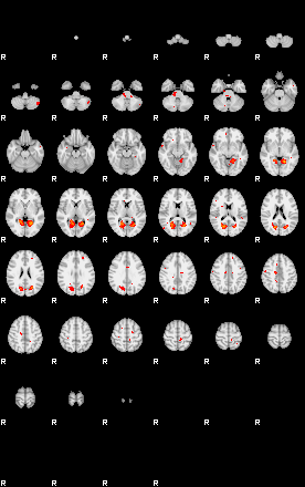 Patients 29182 27