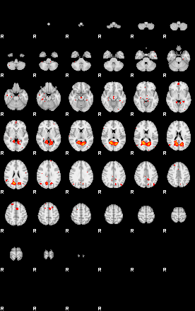 Patients 29183 25