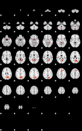 Patients 29184 25