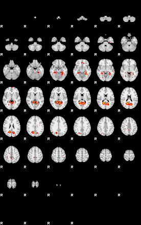 Patients 29193 30