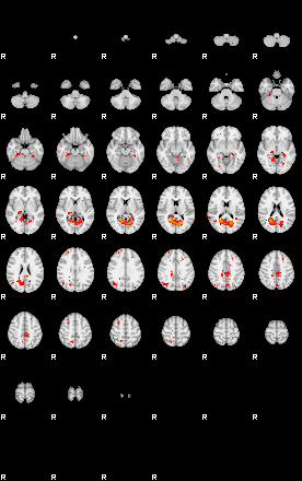 Patients 29200 77