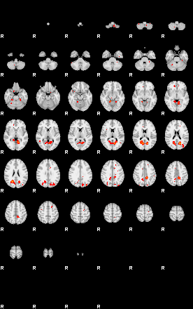 Patients 29208 23