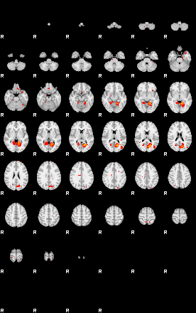 Patients 29213 25