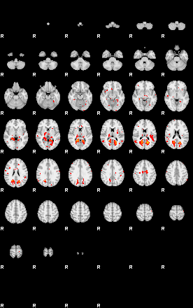 Patients 29219 25