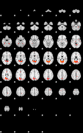 Patients 29292 12