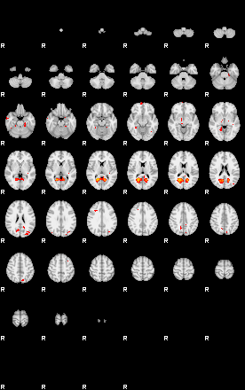 Patients 29344 28