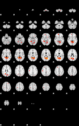 Patients 29393 23