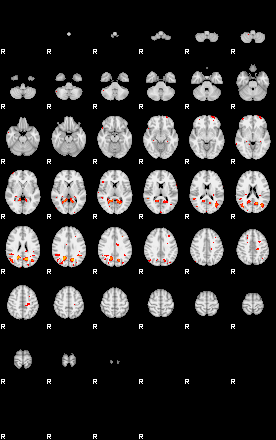 Patients 29401 24