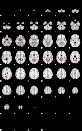 Patients 29411 76