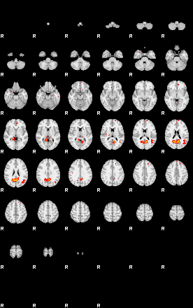 Patients 29413 75