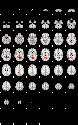 Patients 29509 115