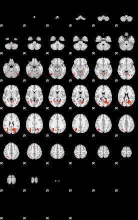 Patients 29510 23