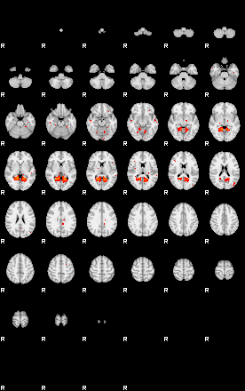 Patients 29515 74