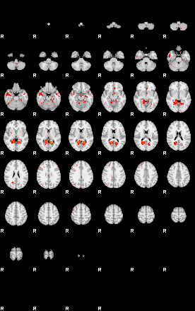 Patients 29522 75