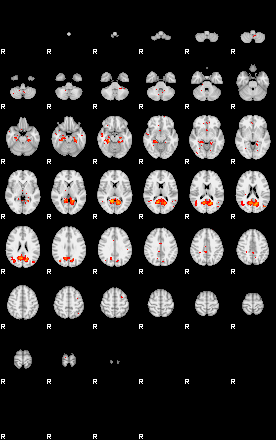 Patients 29561 26