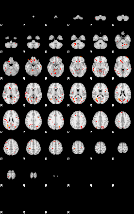 Patients 29615 35