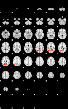 Patients 29737 29