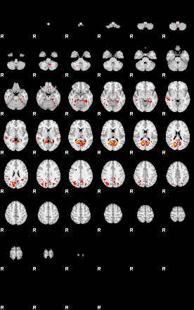 Patients 30013 2