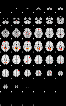 Patients 30018 29