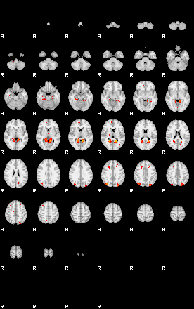 Patients 30175 2