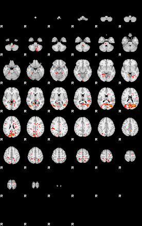 Patients 30176 25