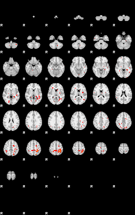 Patients 29009 60