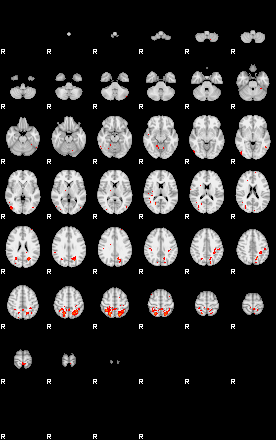 Patients 29010 124