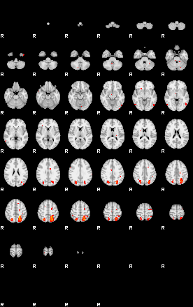 Patients 29182 113