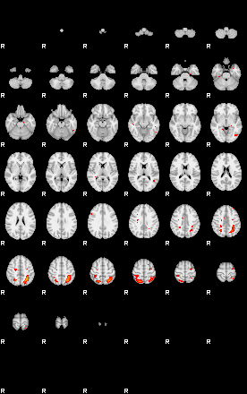 Patients 29185 104