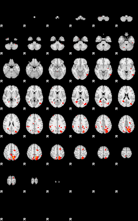 Patients 29210 98