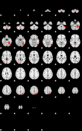 Patients 29214 172