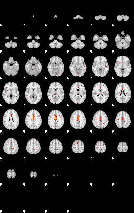 Patients 29153 31