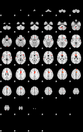 Patients 29163 143