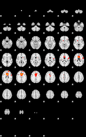 Patients 29164 193