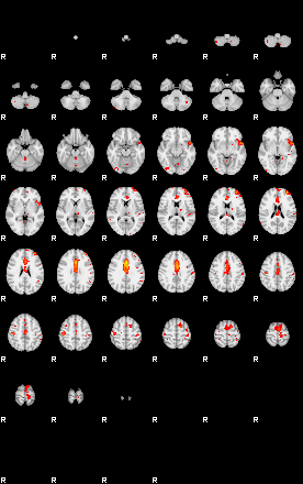 Patients 29289 191