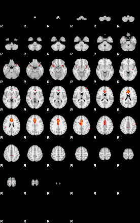 Patients 29389 193