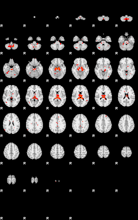 Patients 29189 103