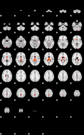 Patients 29541 200