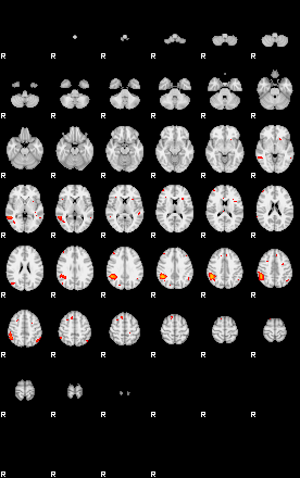 Patients 29174 139