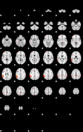 Patients 29511 55