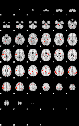 Patients 29615 177