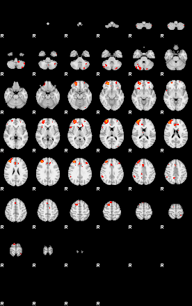 Patients 29107 110