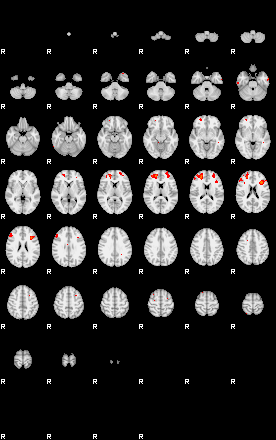 Patients 29161 192