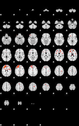 Patients 29218 21