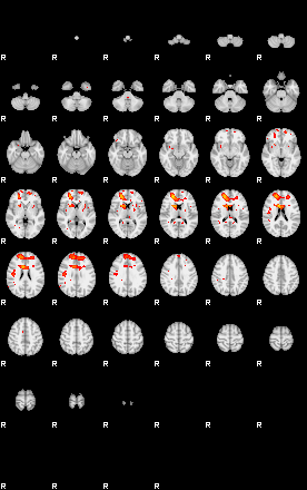 Patients 29411 21