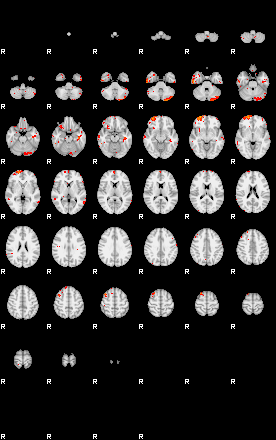 Patients 30183 15