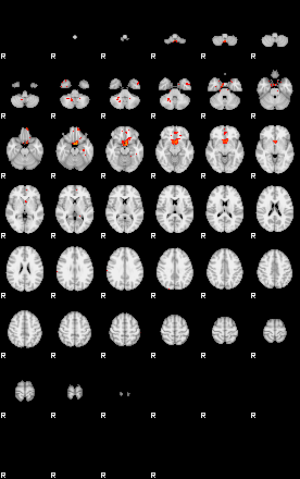 Patients 28718 27